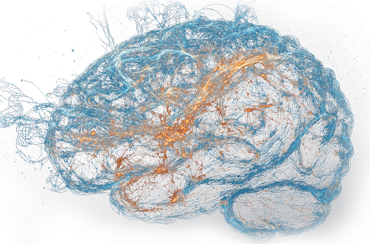 Brain image