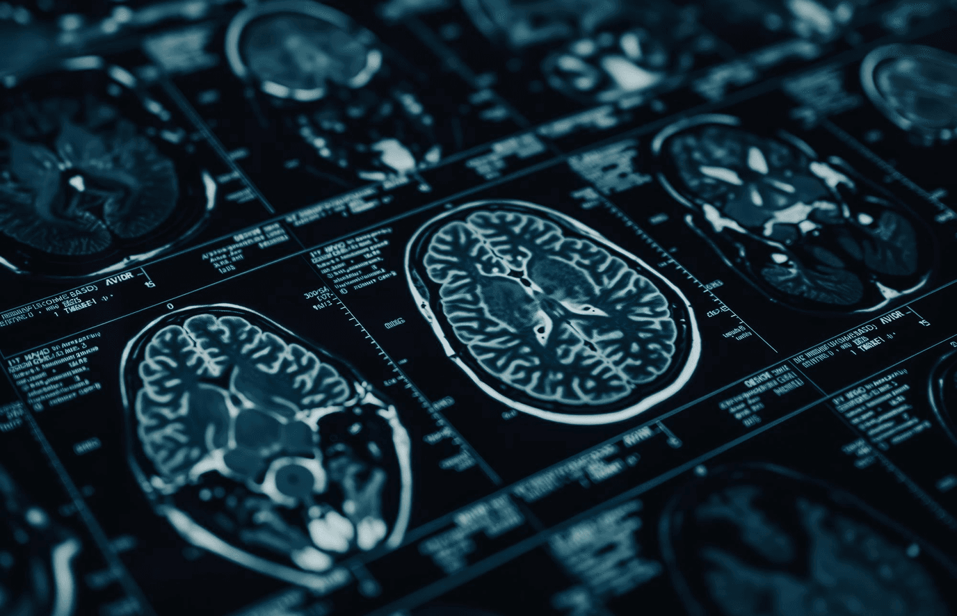 Some Radiology Images