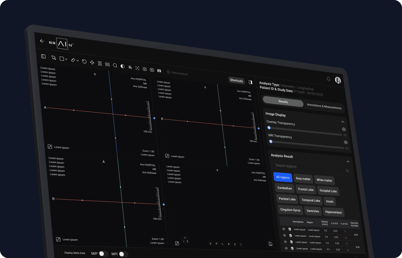 Application interface with viewports